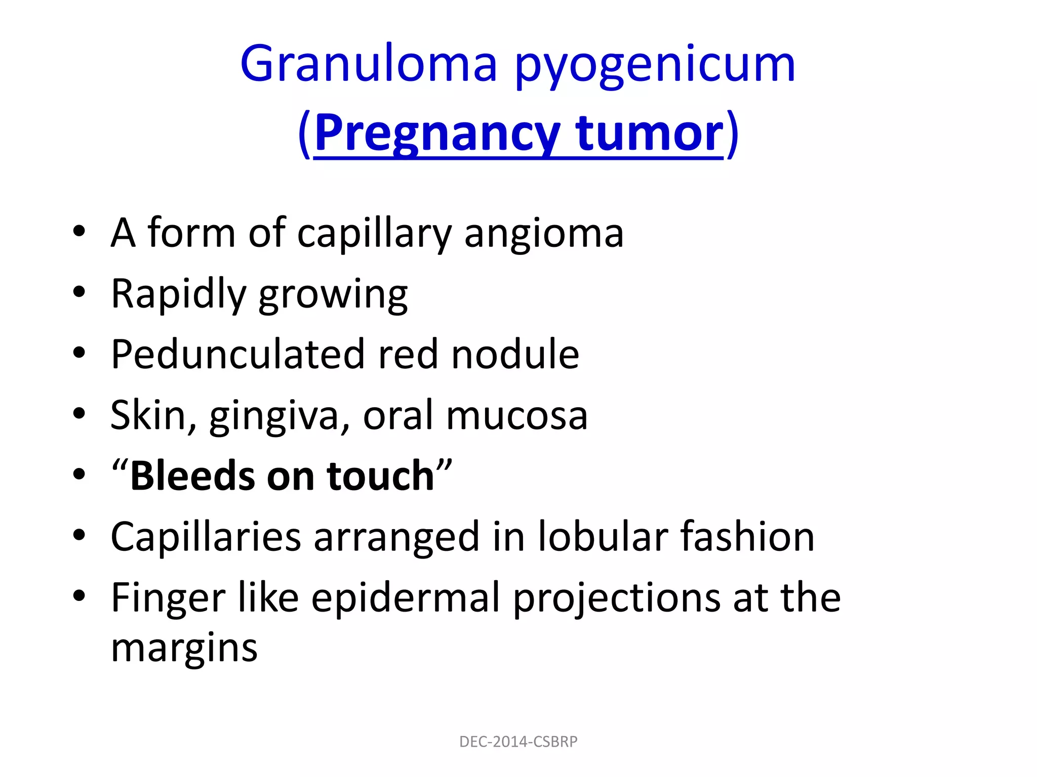 Granuloma pyogenicum
(Pregnancy tumor)
• A form of capillary angioma
• Rapidly growing
• Pedunculated red nodule
• Skin, gingiva, oral mucosa
• “Bleeds on touch”
• Capillaries arranged in lobular fashion
• Finger like epidermal projections at the
margins
DEC-2014-CSBRP
 