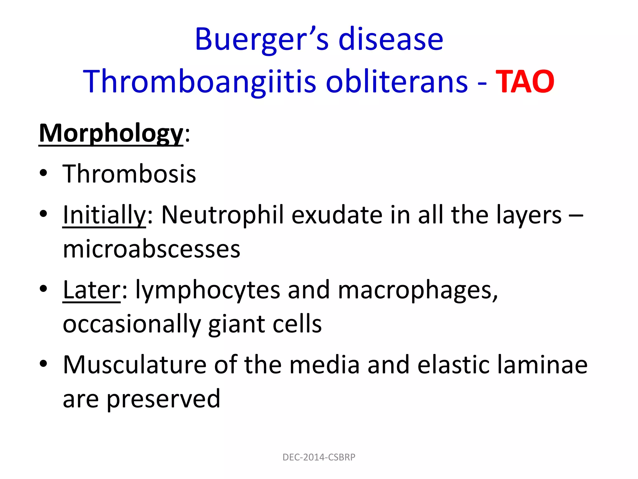 Buerger’s disease
Thromboangiitis obliterans - TAO
Morphology:
• Thrombosis
• Initially: Neutrophil exudate in all the layers –
microabscesses
• Later: lymphocytes and macrophages,
occasionally giant cells
• Musculature of the media and elastic laminae
are preserved
DEC-2014-CSBRP
 