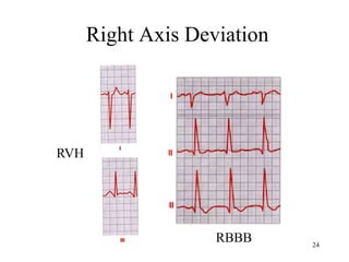 CVS 04 12.ppt fgftfhjhjhjghggghghjjhjhjhjh | PPT