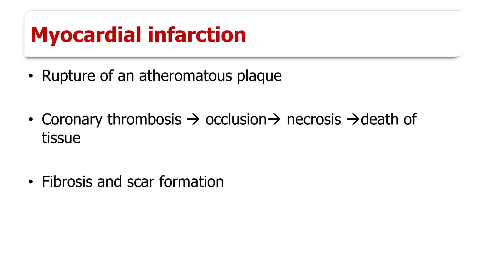 Myocardial infarction
• Rupture of an atheromatous plaque
• Coronary thrombosis → occlusion→ necrosis →death of
tissue
• Fibrosis and scar formation
 