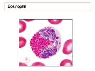 Eosinophil
 