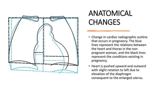 Cardiovascular changes in pregnancy | PPTX | Pregnancy | Reproductive ...