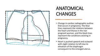 Cardiovascular changes in pregnancy | PPT