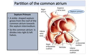 Partition of the common atrium
Septum Primum
• A sickle- shaped septum
grows from the roof of the
common atrium towards
the septum intermedium.
• So the common atrium is
divides into right & left
halves.
 