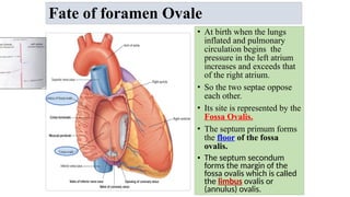 • At birth when the lungs
inflated and pulmonary
circulation begins the
pressure in the left atrium
increases and exceeds that
of the right atrium.
• So the two septae oppose
each other.
• Its site is represented by the
Fossa Ovalis.
• The septum primum forms
the floor of the fossa
ovalis.
• The septum secondum
forms the margin of the
fossa ovalis which is called
the limbus ovalis or
(annulus) ovalis.
Fate of foramen Ovale
 