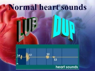Normal heart sounds
 