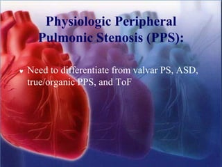 Physiologic Peripheral
Pulmonic Stenosis (PPS):
 Need to differentiate from valvar PS, ASD,
true/organic PPS, and ToF
 