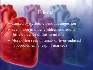 Edema:
 Caused by systemic venous congestion
 Seen more in older children and adults
(little evidence of this in infants)
 More often seen in renal- or liver-induced
hypoproteinemia (esp. if marked)
 