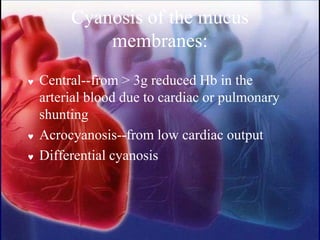 Cyanosis of the mucus
membranes:
 Central--from > 3g reduced Hb in the
arterial blood due to cardiac or pulmonary
shunting
 Acrocyanosis--from low cardiac output
 Differential cyanosis
 