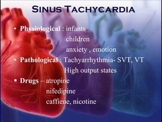 Sinus Tachycardia
• Physiological : infants
children
anxiety , emotion
• Pathological : Tachyarrhythmia- SVT, VT
High output states
▪ Drugs – atropine
nifedipine
caffiene, nicotine
 