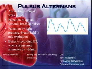 Pulsus Alternans
• Alternating strong &
weak pulse.
• Palpation of radial,
femoral, brachial pulses
• Palpation by light
pressure, breath held in
mid expiration
• Better – recording BP,
when sys.pressure
alternates by >20mm
Pulsus Alternans Strong and weak beat occurring
alternately
LVF
Toxic myocarditis
Paroxysmal Tachycardias
Following Premature beat
 