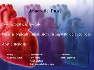 Anacrotic Pulse
Two upbeats, in systole
Pulse is typically small slow rising with delayed peak.
Aortic stenosis
Pulse/ Characteristic Examples
Anacrotic Pulse Slow rising
Twice beating
Both waves felt in systole
Aortic Stenosis
 