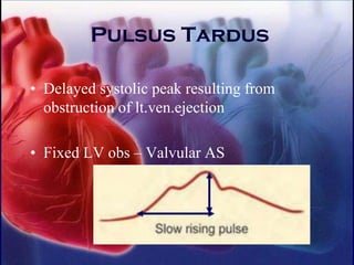 Pulsus Tardus
• Delayed systolic peak resulting from
obstruction of lt.ven.ejection
• Fixed LV obs – Valvular AS
 