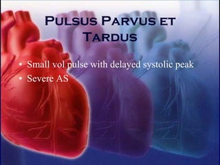 Pulsus Parvus et
Tardus
• Small vol pulse with delayed systolic peak
• Severe AS
 