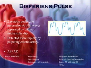 Bisferiens Pulse
• 2 systolic peaks ,the
percussion & tidal waves
separated by distinct
midsystolic dip.
• Detected more rapidly by
palpating carotid artery.
• AS+AR
Pulsus Bisferiens Rapid rising
Twice beating
Both waves felt in systole
Idiopathic Hypertrophic
Subaortic Stenosis(jerky pulse)
Severe AR with mild AS
HOCM
 