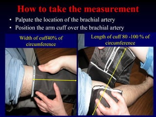 How to take the measurement
• Palpate the location of the brachial artery
• Position the arm cuff over the brachial artery
Width of cuff40% of
circumference
Length of cuff 80 -100 % of
circumference
 