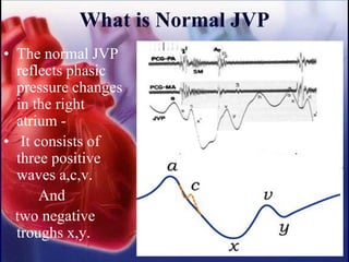 What is Normal JVP
• The normal JVP
reflects phasic
pressure changes
in the right
atrium -
• It consists of
three positive
waves a,c,v.
And
two negative
troughs x,y.
 