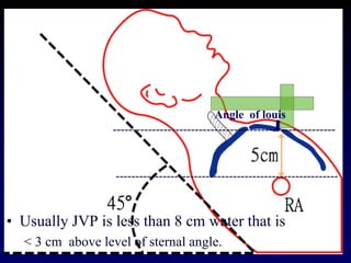 ---------------------------------------------------------
---------------------------------------------------------
Angle of louis
• Usually JVP is less than 8 cm water that is
< 3 cm above level of sternal angle.
 