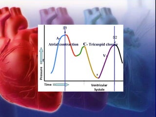 A-
Atrial contraction C- Tricuspid closure
• V-
f
 