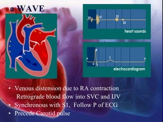 • Venous distension due to RA contraction
Retrograde blood flow into SVC and IJV
• Synchronous with S1, Follow P of ECG
• Precede Carotid pulse
a WAVE
 