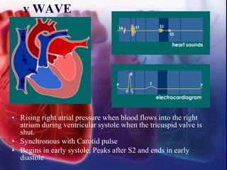 v WAVE
• Rising right atrial pressure when blood flows into the right
atrium during ventricular systole when the tricuspid valve is
shut.
• Synchronous with Carotid pulse
• Begins in early systole, Peaks after S2 and ends in early
diastole
 