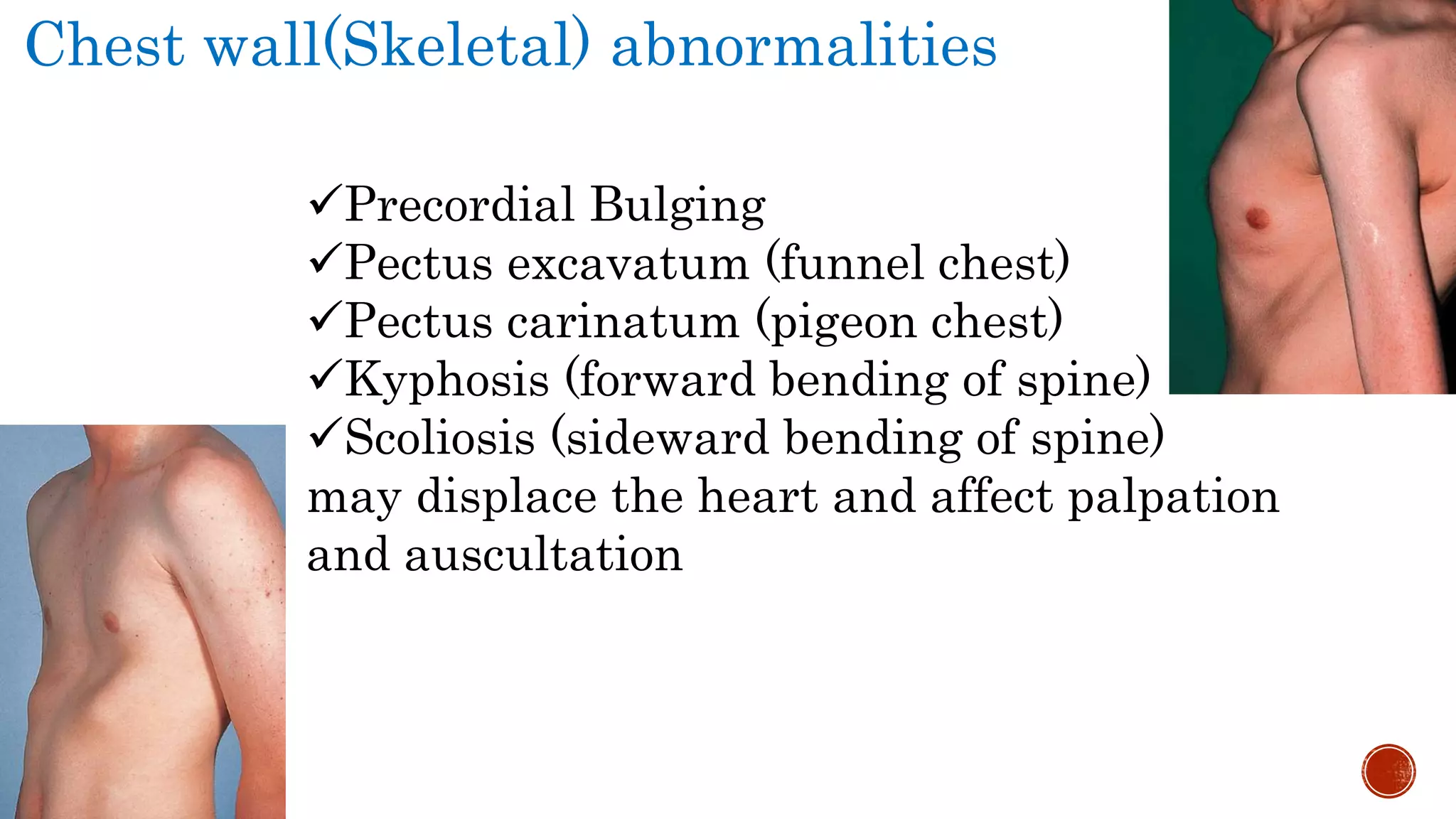 Clinical Examination of CVS | PPTX