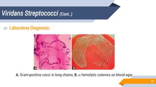 Viridans Streptococci (Cont..)
32
▰ Laboratory Diagnosis:
A. Gram-positive cocci in long chains; B. α hemolytic colonies on blood agar
 