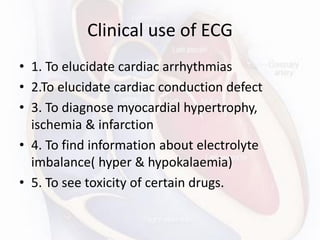 Clinical use of ECG
• 1. To elucidate cardiac arrhythmias
• 2.To elucidate cardiac conduction defect
• 3. To diagnose myocardial hypertrophy,
ischemia & infarction
• 4. To find information about electrolyte
imbalance( hyper & hypokalaemia)
• 5. To see toxicity of certain drugs.
 