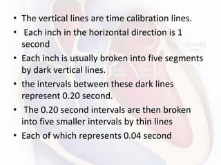 • The vertical lines are time calibration lines.
• Each inch in the horizontal direction is 1
second
• Each inch is usually broken into five segments
by dark vertical lines.
• the intervals between these dark lines
represent 0.20 second.
• The 0.20 second intervals are then broken
into five smaller intervals by thin lines
• Each of which represents 0.04 second
 