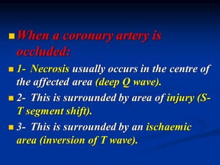 ◼When a coronary artery is
occluded:
◼ 1- Necrosis usually occurs in the centre of
the affected area (deep Q wave).
◼ 2- This is surrounded by area of injury (S-
T segment shift).
◼ 3- This is surrounded by an ischaemic
area (inversion of T wave).
 