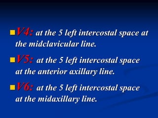 ◼V4: at the 5 left intercostal space at
the midclavicular line.
◼V5: at the 5 left intercostal space
at the anterior axillary line.
◼V6: at the 5 left intercostal space
at the midaxillary line.
 