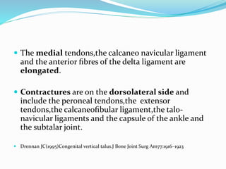  The medial tendons,the calcaneo navicular ligament
and the anterior ﬁbres of the delta ligament are
elongated.
 Contractures are on the dorsolateral side and
include the peroneal tendons,the extensor
tendons,the calcaneoﬁbular ligament,the talo-
navicular ligaments and the capsule of the ankle and
the subtalar joint.
 Drennan JC(1995)Congenital vertical talus.J Bone Joint Surg Am77:1916–1923
 