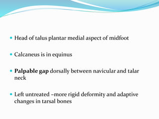  Head of talus plantar medial aspect of midfoot
 Calcaneus is in equinus
 Palpable gap dorsally between navicular and talar
neck
 Left untreated –more rigid deformity and adaptive
changes in tarsal bones
 