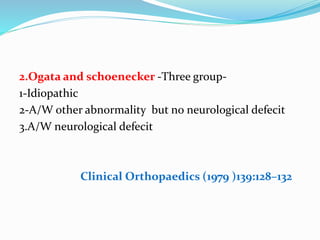 2.Ogata and schoenecker -Three group-
1-Idiopathic
2-A/W other abnormality but no neurological defecit
3.A/W neurological defecit
Clinical Orthopaedics (1979 )139:128–132
 