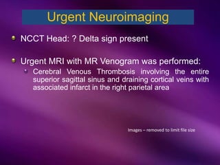 NCCT Head: ? Delta sign present
Urgent MRI with MR Venogram was performed:
Cerebral Venous Thrombosis involving the entire
superior sagittal sinus and draining cortical veins with
associated infarct in the right parietal area
Urgent Neuroimaging
Images – removed to limit file size
 