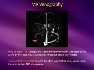Time of flight (TOF) venography is routinely performed in suspected cases.
(Done by MRI techniques without contrast but prone to artifacts)
Contrast MR venography is more sensitive in detecting dural venous sinus
thrombosis than TOF venography.
 