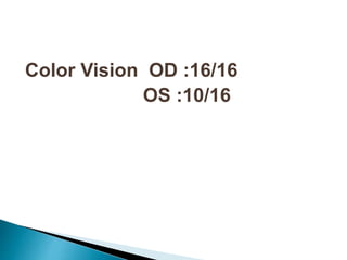Colour vision test | PPTX