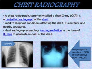 Testing Cxr Cardiovascular testing 1 | PPTX