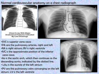 Cardiovascular testing 1 | PPTX