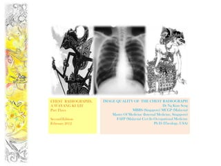 CHEST RADIOGRAPHS,   IMAGE QUALITY OF THE CHEST RADIOGRAPH
A WAYANG KULIT                                           Dr Ng Kian Seng
Part Three                           MBBS (Singapore) MCGP (Malaysia)
                         Master Of Medicine (Internal Medicine, Singapore)
Second Edition             FAFP (Malaysia) Cert In Occupational Medicine
February 2012                                       Ph D (Theology, USA)
 