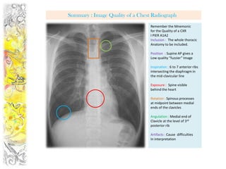 Summary : Image Quality of a Chest Radiograph
                                  Remember the Mnemonic
                                  for the Quality of a CXR
                                  I PIER A1A2
                                  Inclusion : The whole thoracic
                                  Anatomy to be included.

                                  Position : Supine AP gives a
                                  Low quality “fuzzier” Image

                                  Inspiration : 6 to 7 anterior ribs
                                  intersecting the diaphragm in
                                  the mid-clavicular line

                                  Exposure : Spine visible
                                  behind the heart

                                  Rotation : Spinous processes
                                  at midpoint between medial
                                  ends of the clavicles

                                  Angulation : Medial end of
                                  Clavicle at the level of 3rd
                                  posterior rib

                                  Artifacts : Cause difficulties
                                  In interpretation
 