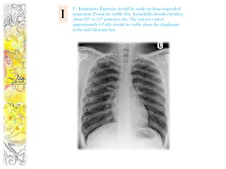 I = Inspiration. Exposure should be made on deep suspended
I   inspiration. Count the visible ribs. Lung fields should extend to
    about 10th or 11th posterior ribs. The anterior end of
    approximately 6-7 ribs should be visible above the diaphragm
    in the mid clavicular line.




                                   1
                               2

                           3
                                            1
                                                2
                       4

                                                 3
                   5

                   6                                 4


               7                                     5


           8
                                                         6
           9
                                                             7


          10
 