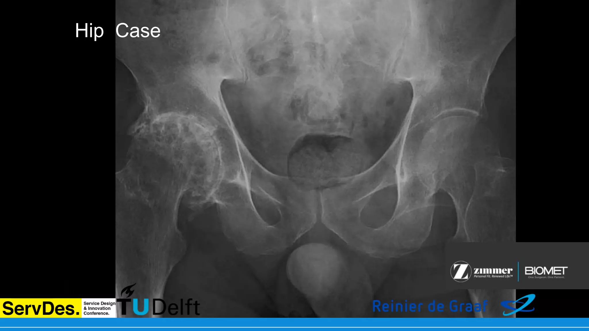 Service Pathway: a Case Study of Business Model Design in Healthcare ...