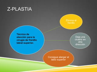 Z-PLASTIA
Elimina el
frenillo

Técnica de
elección para la
cirugía de frenillo
labial superior.

Deja una
cicatriz en
otra
dirección

Consigue alargar el
labio superior

 