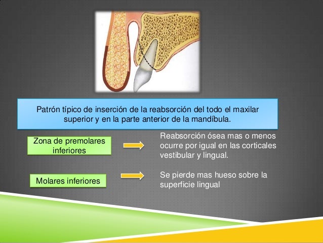 La osteocondrosis la causa de la artrosis de los dedos de las manos