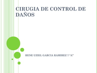 CIRUGIA DE CONTROL DE
DAÑOS
RENE UZIEL GARCIA RAMIREZ 7 “A”
 