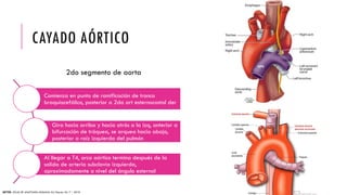 cirugia de aorta con enfoque en anestesiologia | PPTX