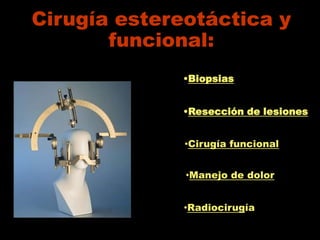 Cirugía estereotáctica y
       funcional:
              •Biopsias


              •Resección de lesiones


              •Cirugía funcional


              •Manejo de dolor


              •Radiocirugía
 
