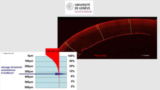 F. Hafezi, MD, PhD
N. GallhöferRed: Actin
 