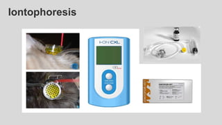 Iontophoresis
Same therapeutic
effects (keratitis)
 